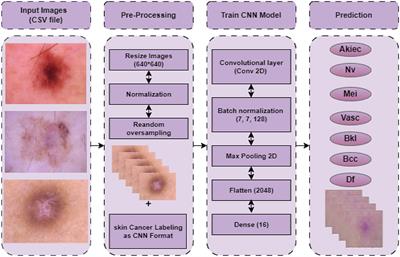 Enhanced skin cancer diagnosis: a deep feature extraction-based framework for the multi-classification of skin cancer utilizing dermoscopy images